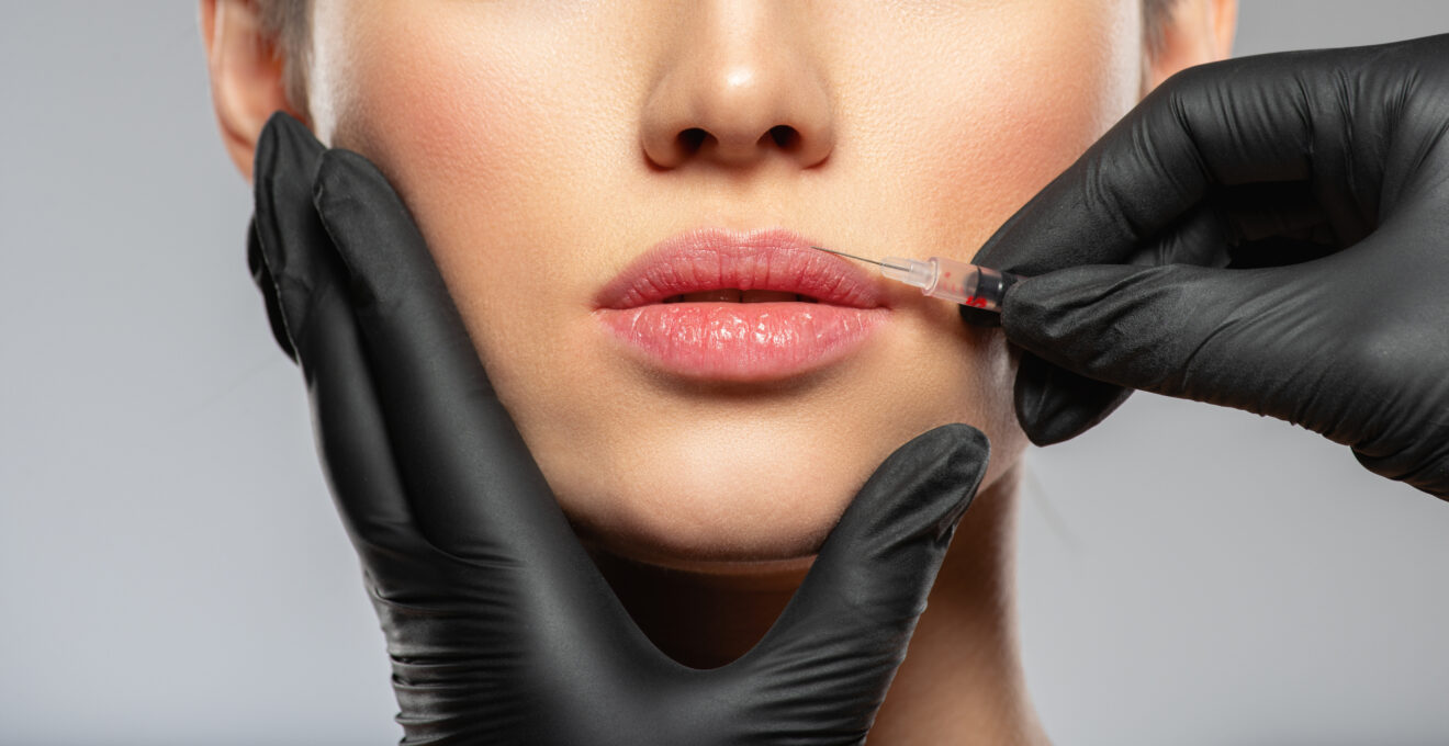 injection des lèvres